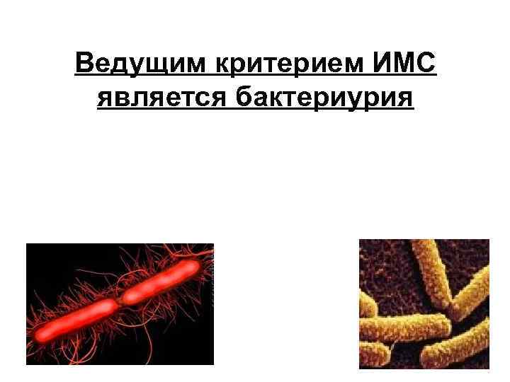 Ведущим критерием ИМС является бактериурия 