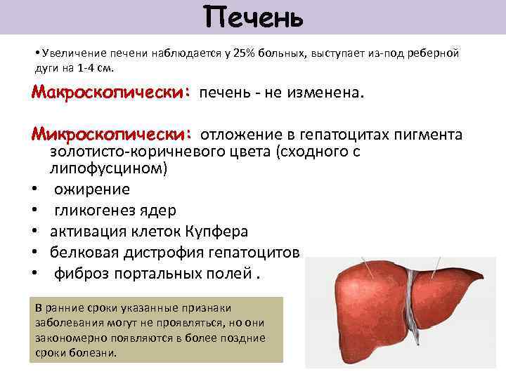 Печень • Увеличение печени наблюдается у 25% больных, выступает из-под реберной дуги на 1