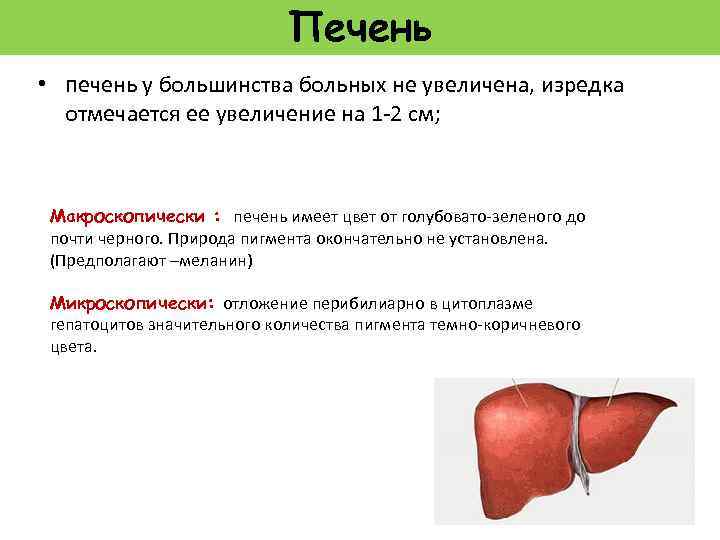 Печень • печень у большинства больных не увеличена, изредка отмечается ее увеличение на 1
