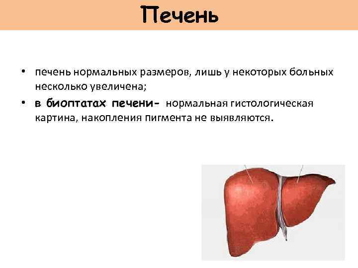 Печень • печень нормальных размеров, лишь у некоторых больных несколько увеличена; • в биоптатах