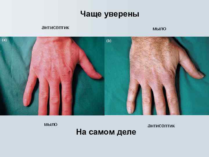 Чаще уверены антисептик мыло На самом деле антисептик 