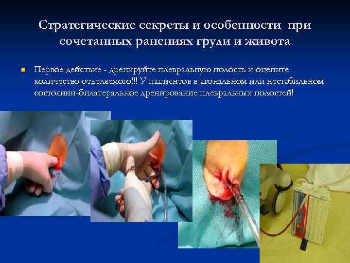 Стратегические секреты и особенности при сочетанных ранениях груди и живота n Первое действие -