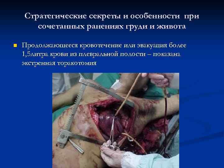 Стратегические секреты и особенности при сочетанных ранениях груди и живота n Продолжающееся кровотечение или