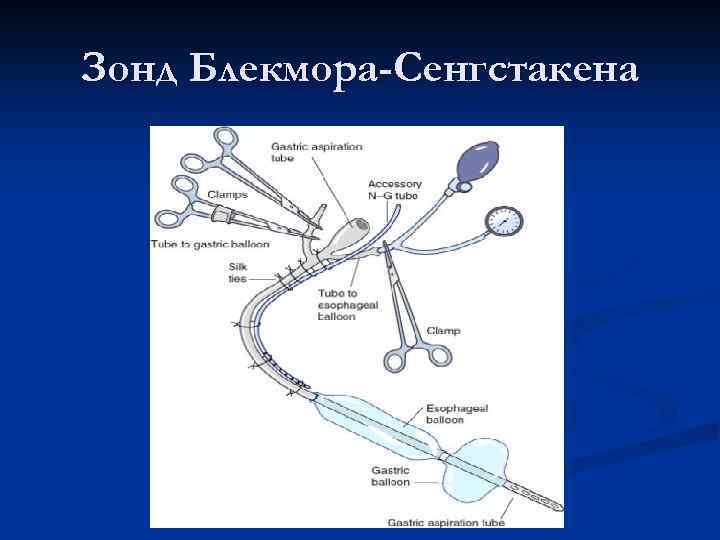 Зонд Блекмора-Сенгстакена 