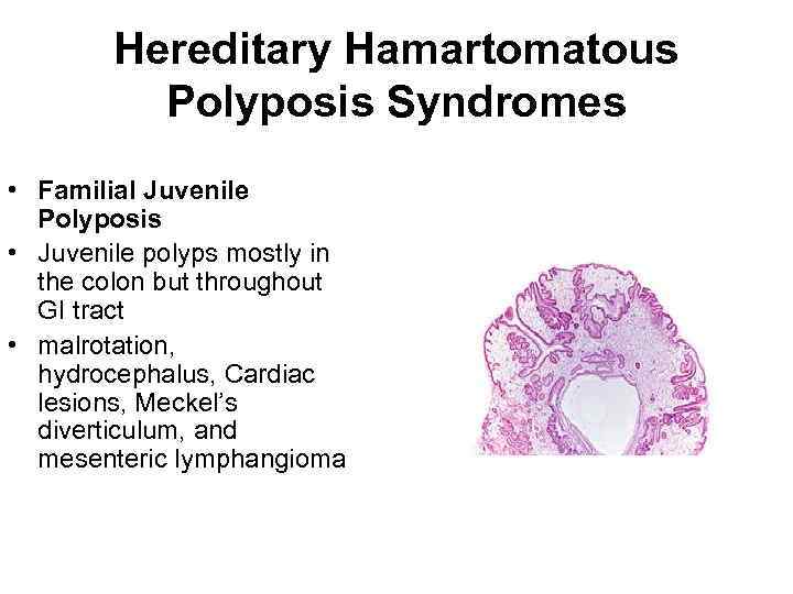 Hereditary Hamartomatous Polyposis Syndromes • Familial Juvenile Polyposis • Juvenile polyps mostly in the