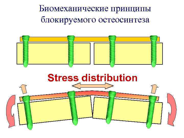 Биомеханические принципы блокируемого остеосинтеза Stress distribution 