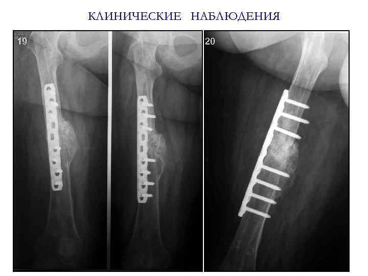 КЛИНИЧЕСКИЕ НАБЛЮДЕНИЯ 19 20 