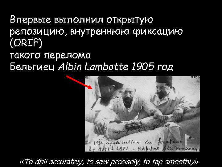 Впервые выполнил открытую репозицию, внутреннюю фиксацию (ORIF) такого перелома Бельгиец Albin Lambotte 1905 год