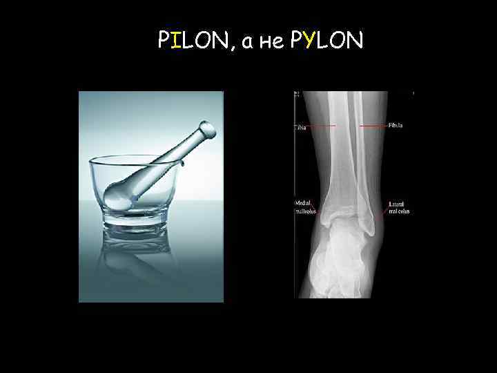 PILON, а не PYLON 