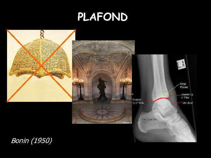 PLAFOND Bonin (1950) 