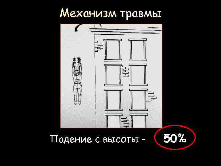 Механизм травмы Падение с высоты - 50% 