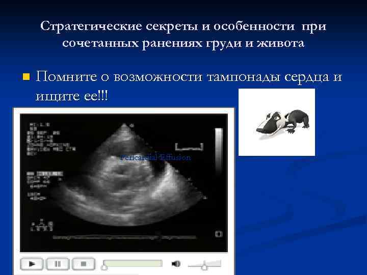 Стратегические секреты и особенности при сочетанных ранениях груди и живота n Помните о возможности