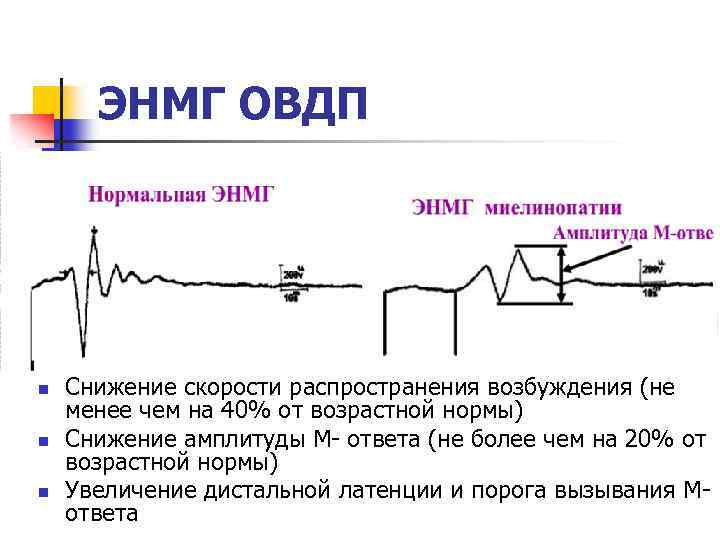 Амплитуда м ответа