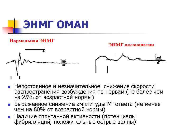 Амплитуда м ответа