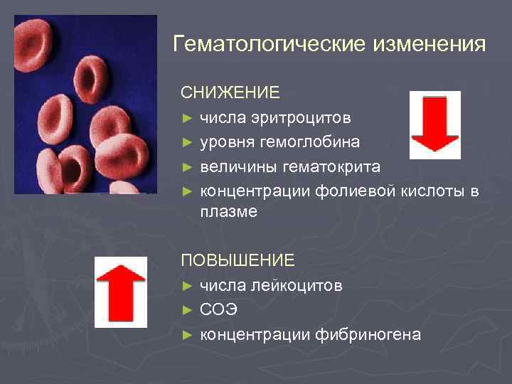 Гематологические изменения СНИЖЕНИЕ ► числа эритроцитов ► уровня гемоглобина ► величины гематокрита ► концентрации