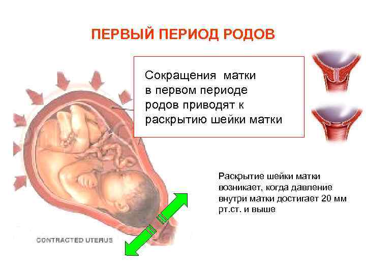 Особенности периода родов. Для первого периода родов, периода раскрытия, характерно. Периоды роды родов первый период. Фазы периода раскрытия шейки матки.