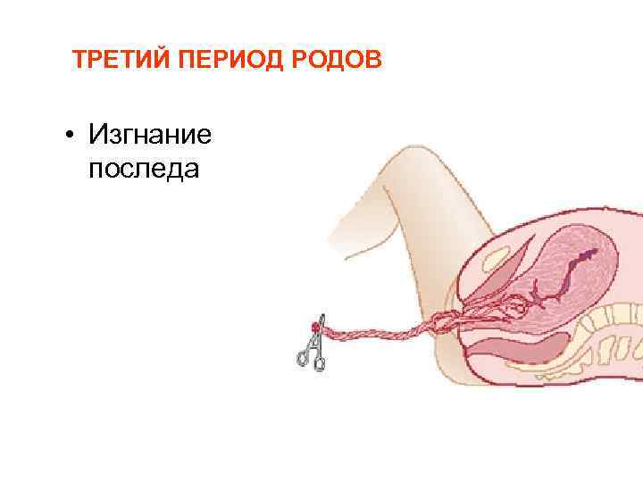 ТРЕТИЙ ПЕРИОД РОДОВ • Изгнание последа 