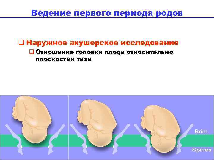 Периоды срочных родов. Ведение первого периода родов. Расположение головки плода относительно плоскостей таза. Течение и ведение первого периода родов. Ведение первого периода родов схема.