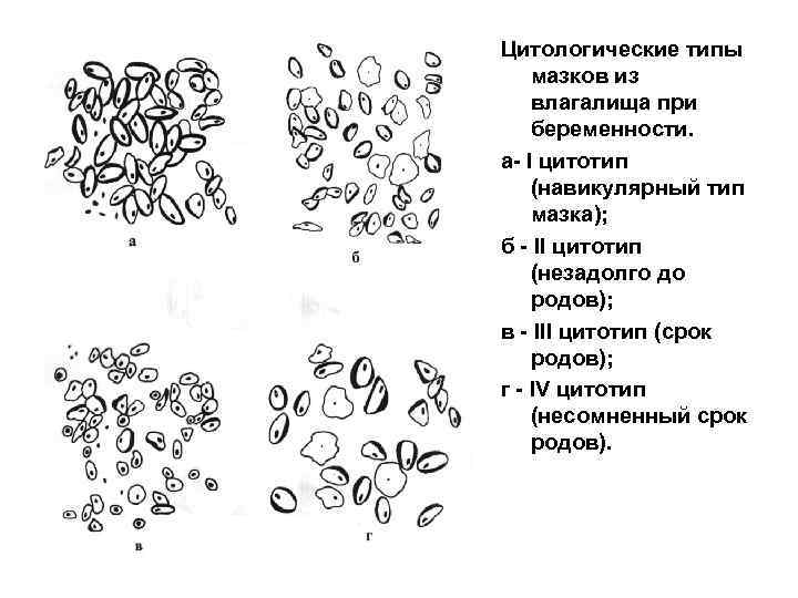 Промежуточный клеточный тип. Тип цитологического влагалищного мазка. Цитологические типы мазков из влагалища. Тип мазка при беременности. Типы влагалищных мазков при беременности.