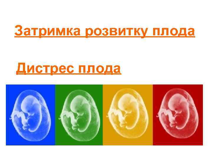 Затримка розвитку плода Дистрес плода 