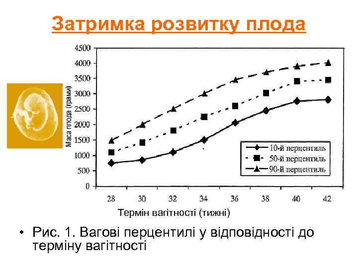 Затримка розвитку плода Термін вагітності (тижні) • Рис. 1. Вагові перцентилі у відповідності до