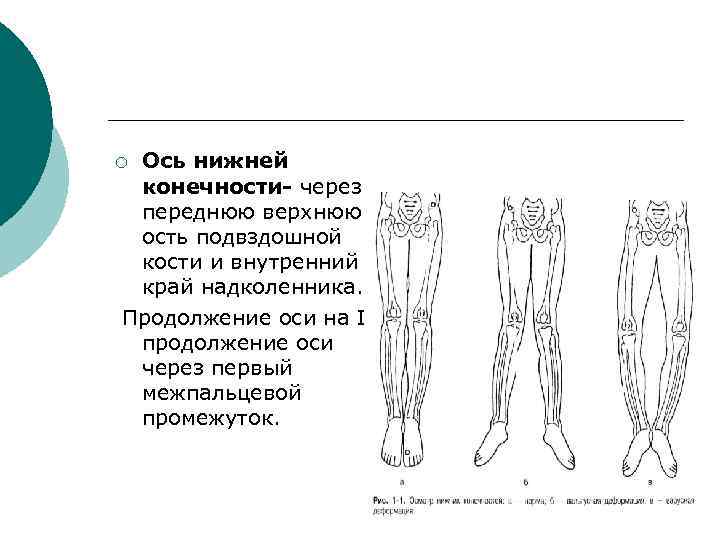 Верхняя ось. Оси нижних конечностей рентген. Ось конечности в травматологии. Варусная деформация верхней конечности.