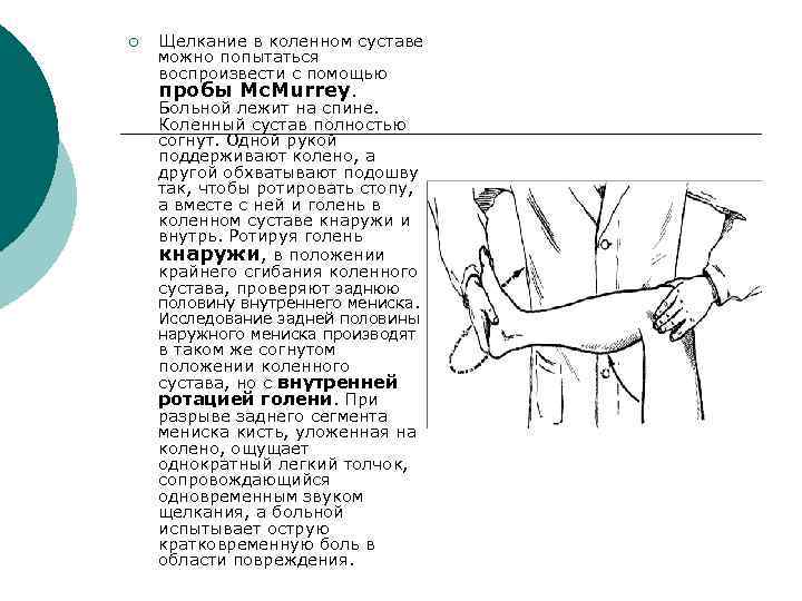 ¡ Щелкание в коленном суставе можно попытаться воспроизвести с помощью пробы Mc. Murrey. Больной