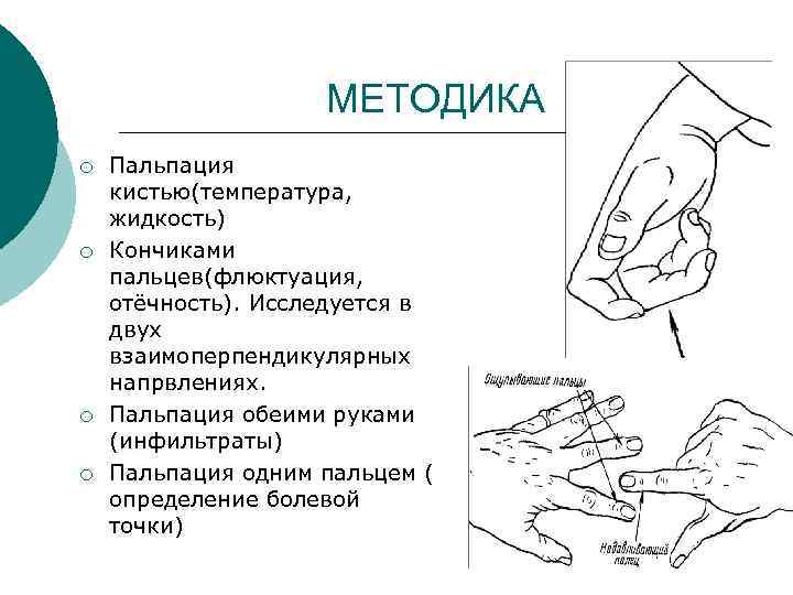 Осмотр пальпация