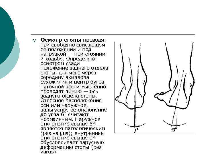 ¡ Осмотр стопы проводят при свободно свисающем ее положении и под нагрузкой — при