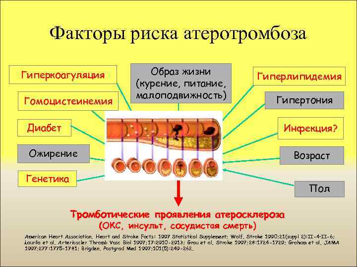 Генетический атеросклероз. Факторы атеросклероза. Модифицируемые факторы атеросклероза. Атеросклероз и Атеротромбоз. Гиперкоагуляция схема.