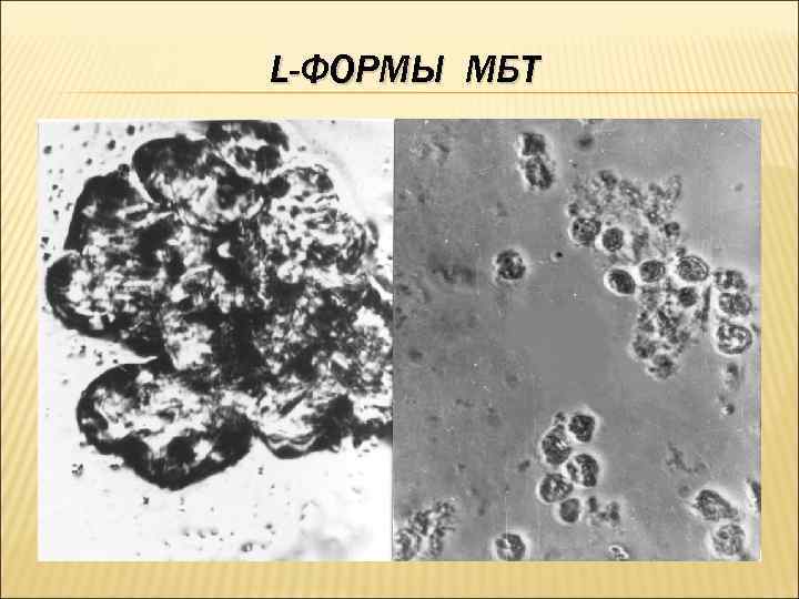 L-ФОРМЫ МБТ 