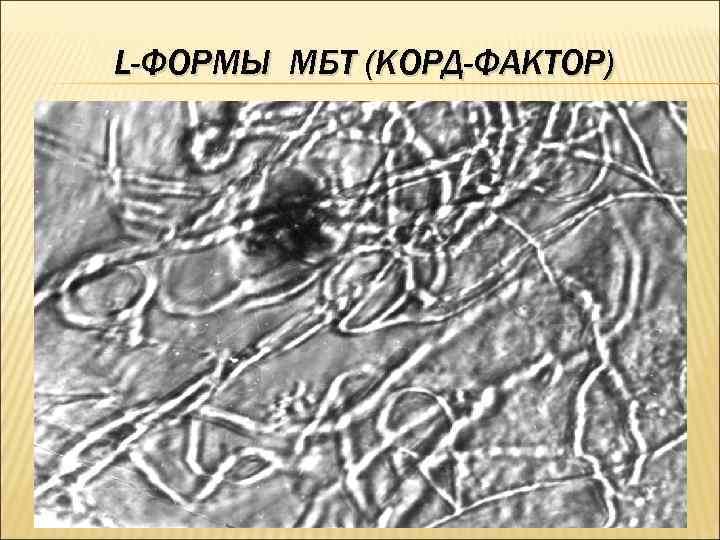 L-ФОРМЫ МБТ (КОРД-ФАКТОР) 