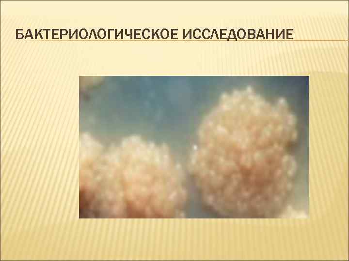 БАКТЕРИОЛОГИЧЕСКОЕ ИССЛЕДОВАНИЕ 