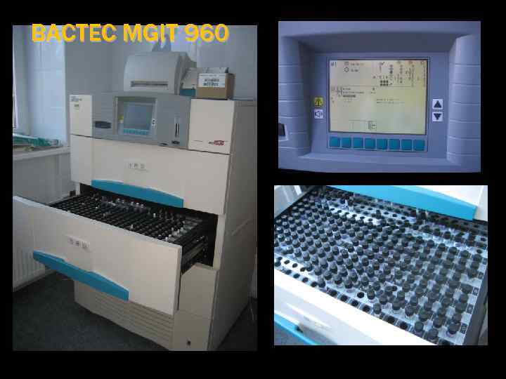 BACTEC MGIT 960 