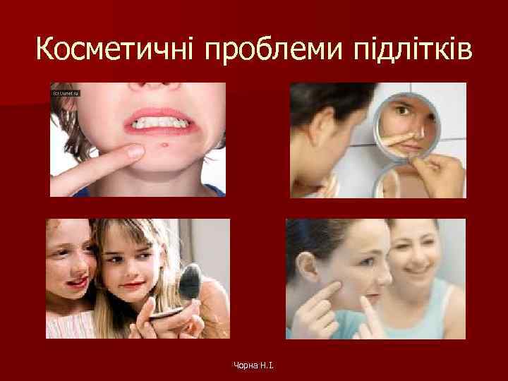 Косметичні проблеми підлітків Чорна Н. І. 