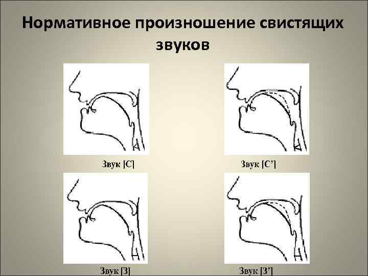 Нормативное произношение свистящих звуков 