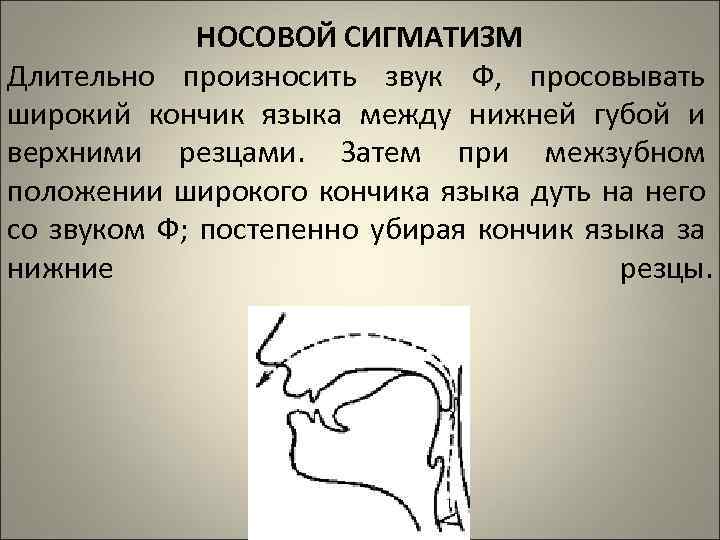 Положение языка. Губно-зубной сигматизм свистящих звуков. Носовой сигматизм это в логопедии. Межзубный сигматизм шипящих звуков. Коррекция носового сигматизма свистящих звуков.