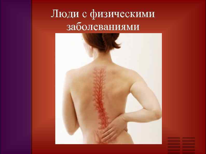 Люди с физическими заболеваниями 
