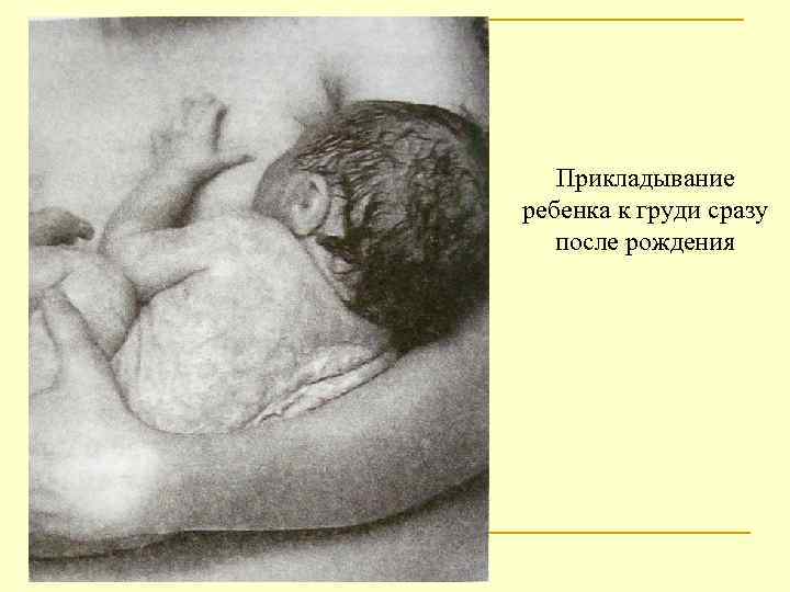 Прикладывание ребенка к груди сразу после рождения 