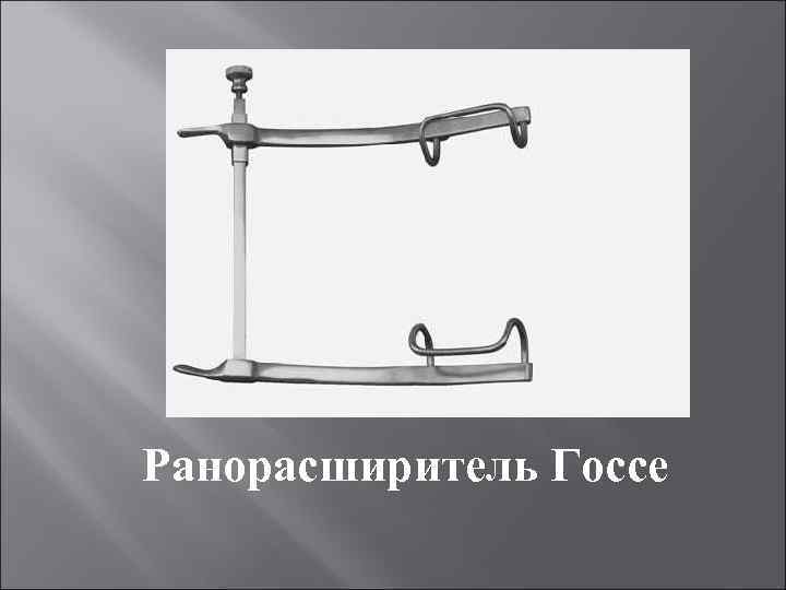 Ранорасширитель Госсе 