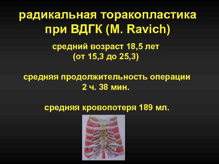 радикальная торакопластика при ВДГК (M. Ravich) средний возраст 18, 5 лет (от 15, 3