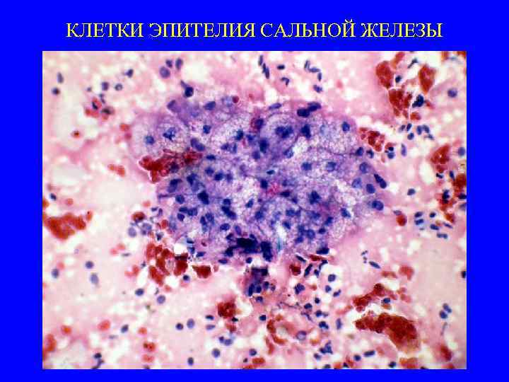 КЛЕТКИ ЭПИТЕЛИЯ САЛЬНОЙ ЖЕЛЕЗЫ 