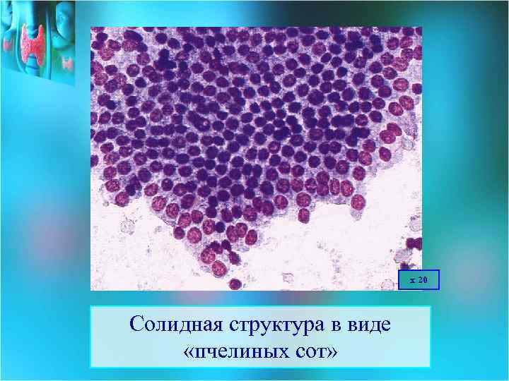 х 20 Солидная структура в виде «пчелиных сот» 