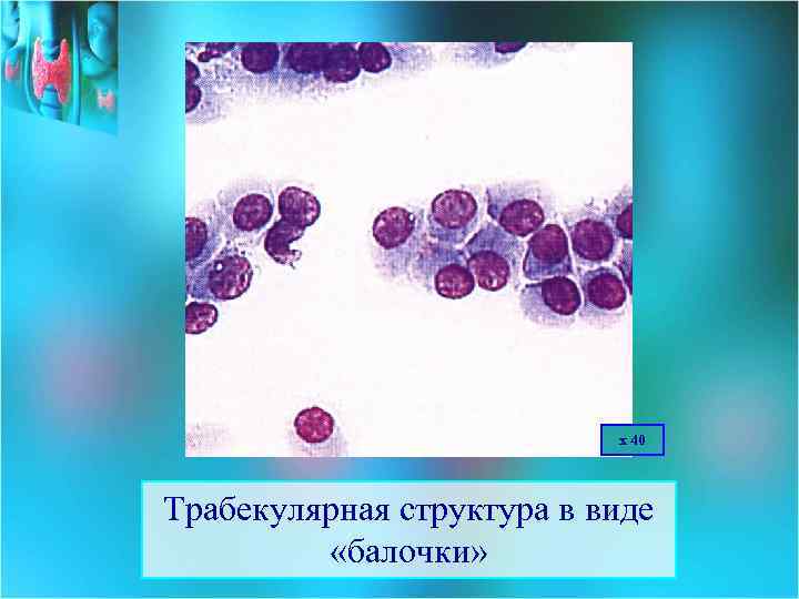 х 40 Трабекулярная структура в виде «балочки» 
