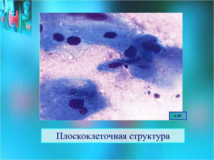 х 40 Плоскоклеточная структура 