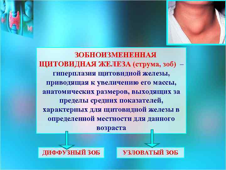 ЗОБНОИЗМЕНЕННАЯ ЩИТОВИДНАЯ ЖЕЛЕЗА (струма, зоб) – гиперплазия щитовидной железы, приводящая к увеличению его массы,