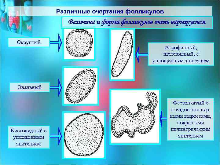 Различные очертания фолликулов Величина и форма фолликулов очень варьируется Округлый Атрофичный, щелевидный, с уплощенным