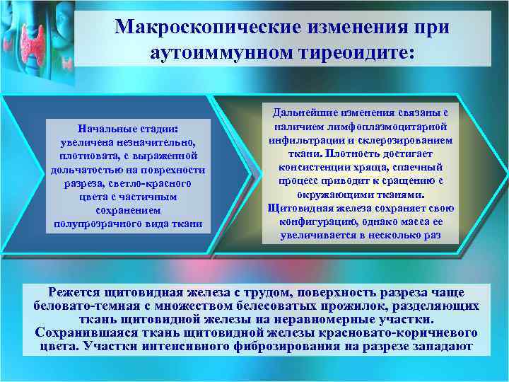 Макроскопические изменения при аутоиммунном тиреоидите: Начальные стадии: увеличена незначительно, плотновата, с выраженной дольчатостью на