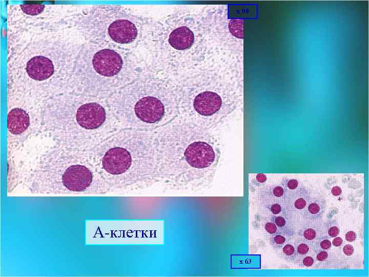 х 90 А клетки х 63 