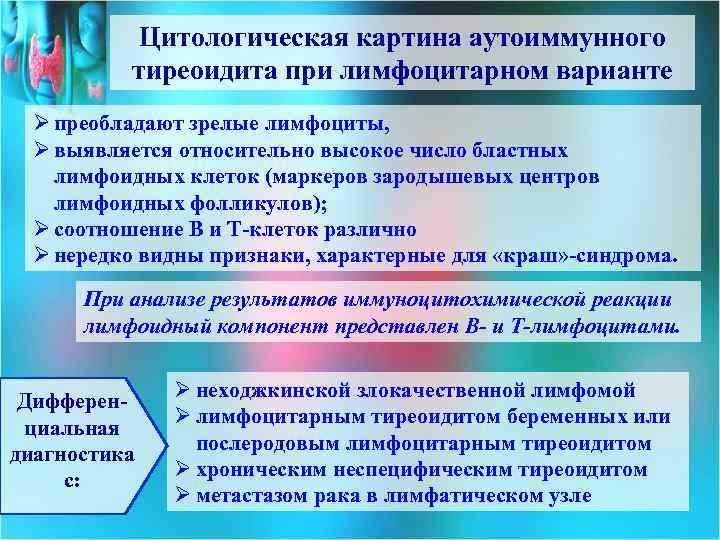 Цитологическая картина аутоиммунного тиреоидита при лимфоцитарном варианте Ø преобладают зрелые лимфоциты, Ø выявляется относительно